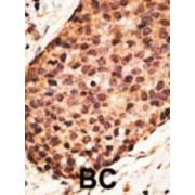 Matrix Metalloproteinase-16 (MMP16) Antibody