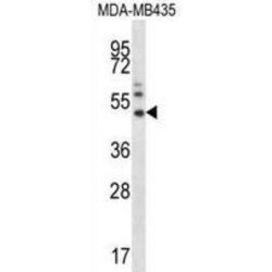 Matrix Metalloproteinase-16 (MMP16) Antibody