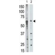 Matrix Metalloproteinase 25 (MMP25) Antibody