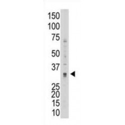 Matrix Metalloproteinase-7 (MMP7) Antibody