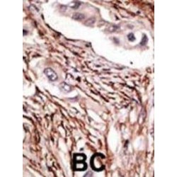 Neurogenic Locus Notch Homolog Protein 3 (NOTCH3) Antibody