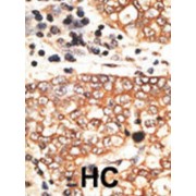 abx032739