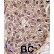 2'-5'-Oligoadenylate Synthetase 1 (OAS1) Antibody