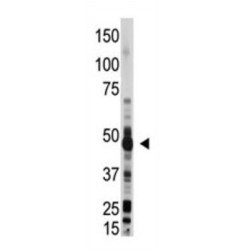 2'-5'-Oligoadenylate Synthetase 1 (OAS1) Antibody