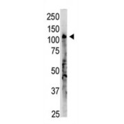 2'-5'-Oligoadenylate Synthetase 3 (OAS3) Antibody