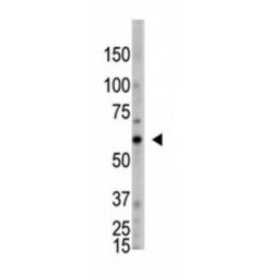 2'-5'-Oligoadenylate Synthase-Like Protein (OASL) Antibody
