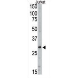 Sirtuin 5 (SIRT5) Antibody