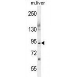 Suppression Of Tumorigenicity 14 (ST14) Antibody
