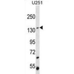 Suppression Of Tumorigenicity 5 (ST5) Antibody