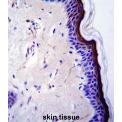 Cellular Tumor Antigen P53 (p53) Antibody