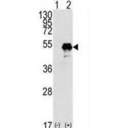 Cellular Tumor Antigen P53 (p53) Antibody