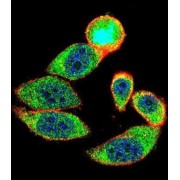 Cyclin-Dependent Kinase Inhibitor P27 (27Kip1) Antibody