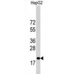 Cyclin-Dependent Kinase Inhibitor P27 (27Kip1) Antibody