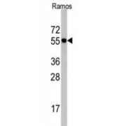 Cell Division Cycle 6 (CDC6) Antibody