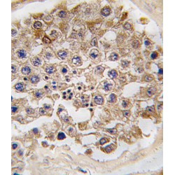 Serine/Threonine-Protein Kinase MTOR (MTOR) Antibody