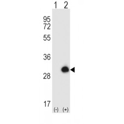 Growth Factor Receptor Bound Protein 2 (GRB2) Antibody