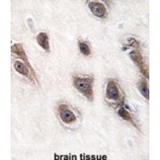 abx032778
