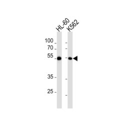 Myocyte-Specific Enhancer Factor 2C (MEF2C) Antibody