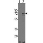 Poly ADP Ribose Polymerase 6 (Parp6) Antibody