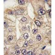 abx032787