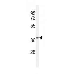 Cluster Of Differentiation 14 (CD14) Antibody