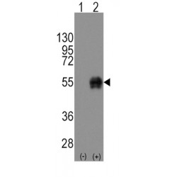 Cluster Of Differentiation 14 (CD14) Antibody