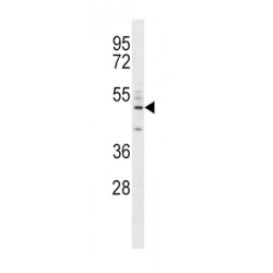 Cluster Of Differentiation 14 (CD14) Antibody