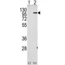 Amyloid-beta Precursor Protein (APP) Antibody