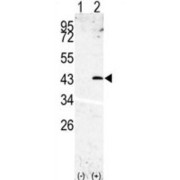 Signal Peptide Peptidase-Like 3 (SPPL3) Antibody