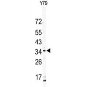 Down Syndrome Critical Region Protein 3 (DSCR3) Antibody