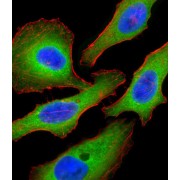 Tuberin (TSC2) Antibody