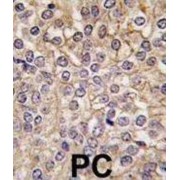 Interleukin-1 Receptor Type 1 (IL1R) Antibody