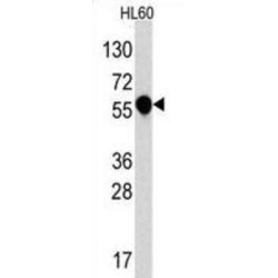 Interleukin-1 Receptor Type 1 (IL1R) Antibody