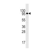 abx032814