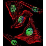Zinc Finger And BTB Domain-Containing Protein 7B (ZBTB7B) Antibody