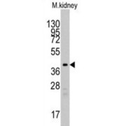 Transforming Growth Factor Beta Regulator 1 (TBRG1) Antibody