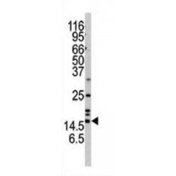 Alpha Synuclein (SNCA) Antibody