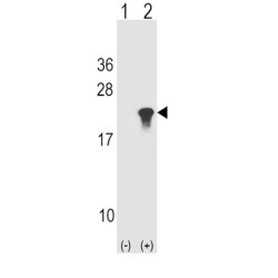 Alpha Synuclein (SNCA) Antibody