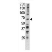 Serine/Threonine-Protein Kinase PINK1, Mitochondrial (PINK1) Antibody