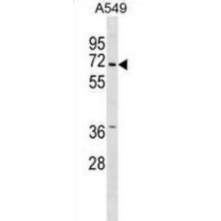 Serine/Threonine-Protein Kinase PINK1, Mitochondrial (PINK1) Antibody
