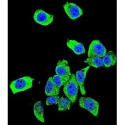 Protein DJ-1 (DJ-1) Antibody