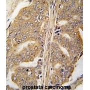 Paxillin (PXN) Antibody