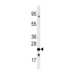 Frataxin (FXN) Antibody