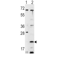 Frataxin (FXN) Antibody