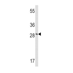 Frataxin (FXN) Antibody