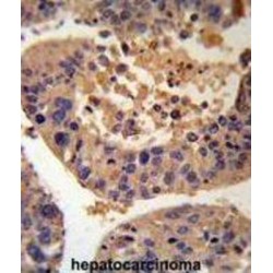 Serine--Pyruvate Aminotransferase (AGXT) Antibody