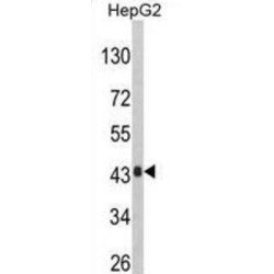 Serine--Pyruvate Aminotransferase (AGXT) Antibody