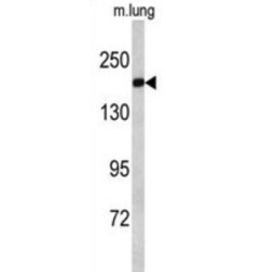 Alsin (ALS2) Antibody