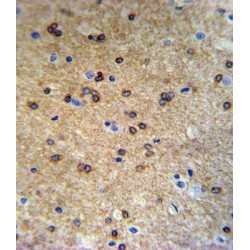 ATPase, Cu++ Transporting Beta Polypeptide (ATP7B) Antibody