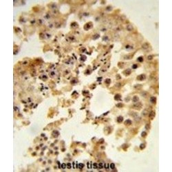 Dipeptidyl Peptidase 8 (DPP8) Antibody